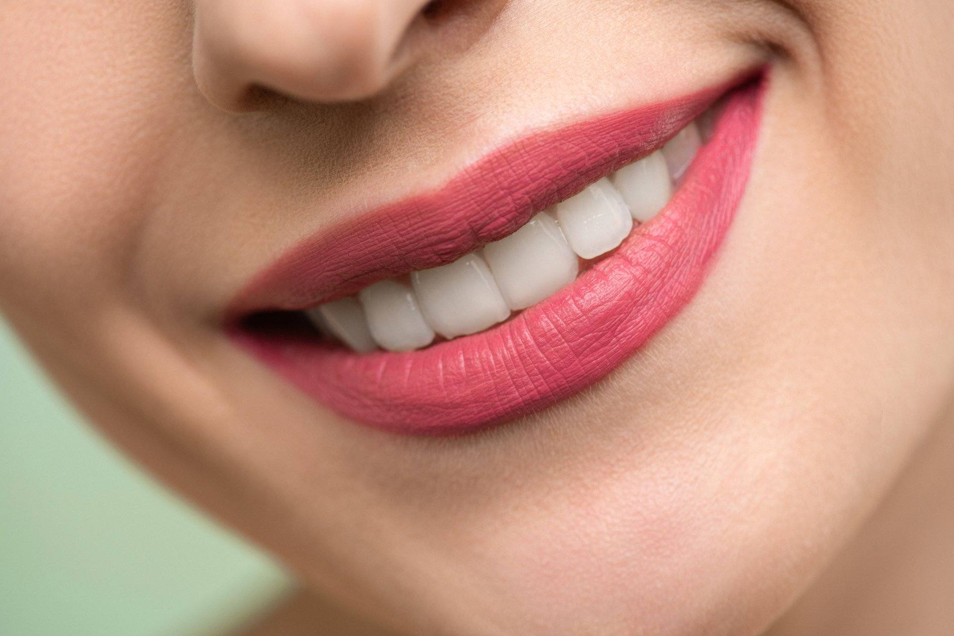 Close-up of a smile with healthy teeth