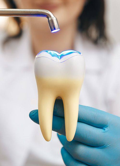 Curing light aimed at a model tooth held in a gloved hand